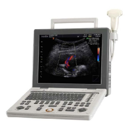 Samsung Medison SonoAce R3 (2)
