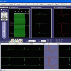 ScottCare HolterCare1 Software