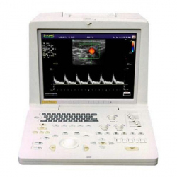 SonoScape SSI-1000