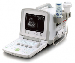 AcuVista VT880f (2)
