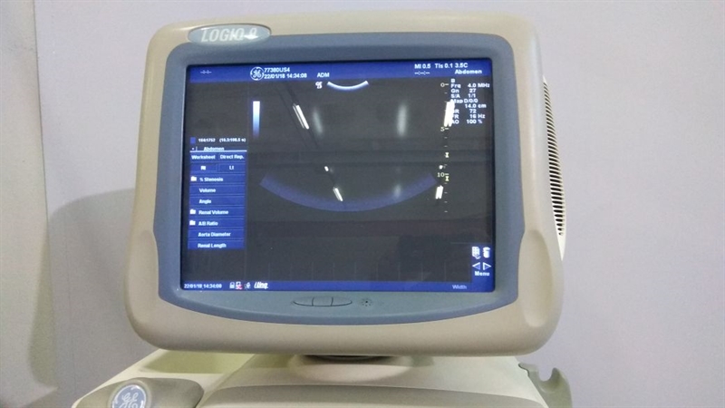 Ультразвуковой сканер LOGIQ 9 GE Healthcare 2