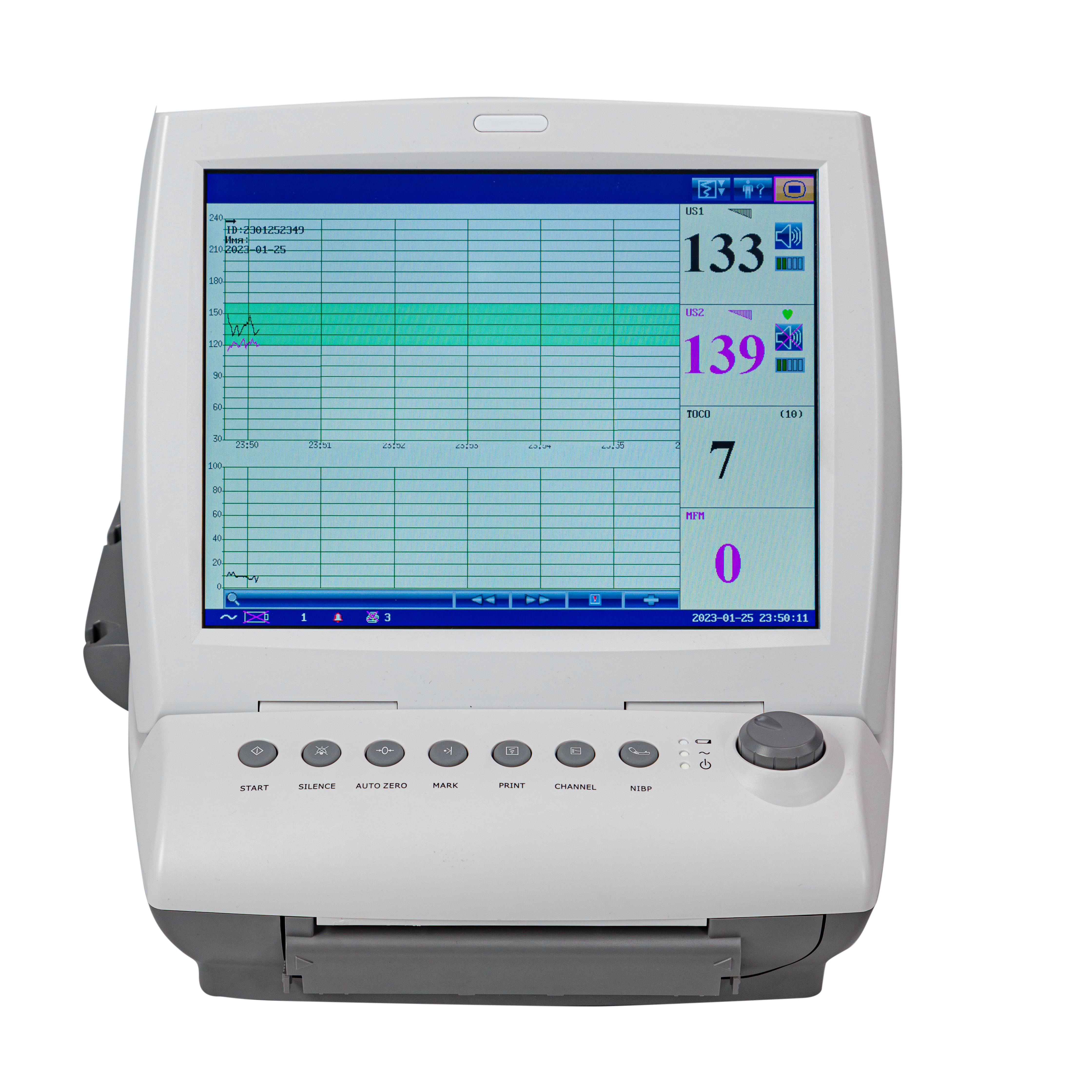 Монитор фетальный "Овертон 6900" 2