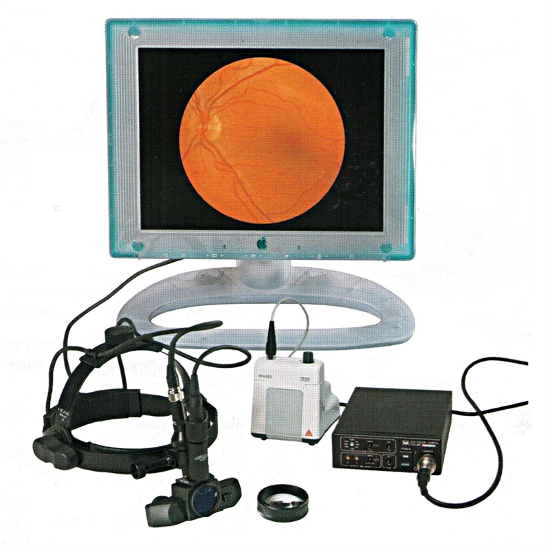 Непрямой бинокулярный офтальмоскоп Video OMEGA 2C  Heine (Германия) 1