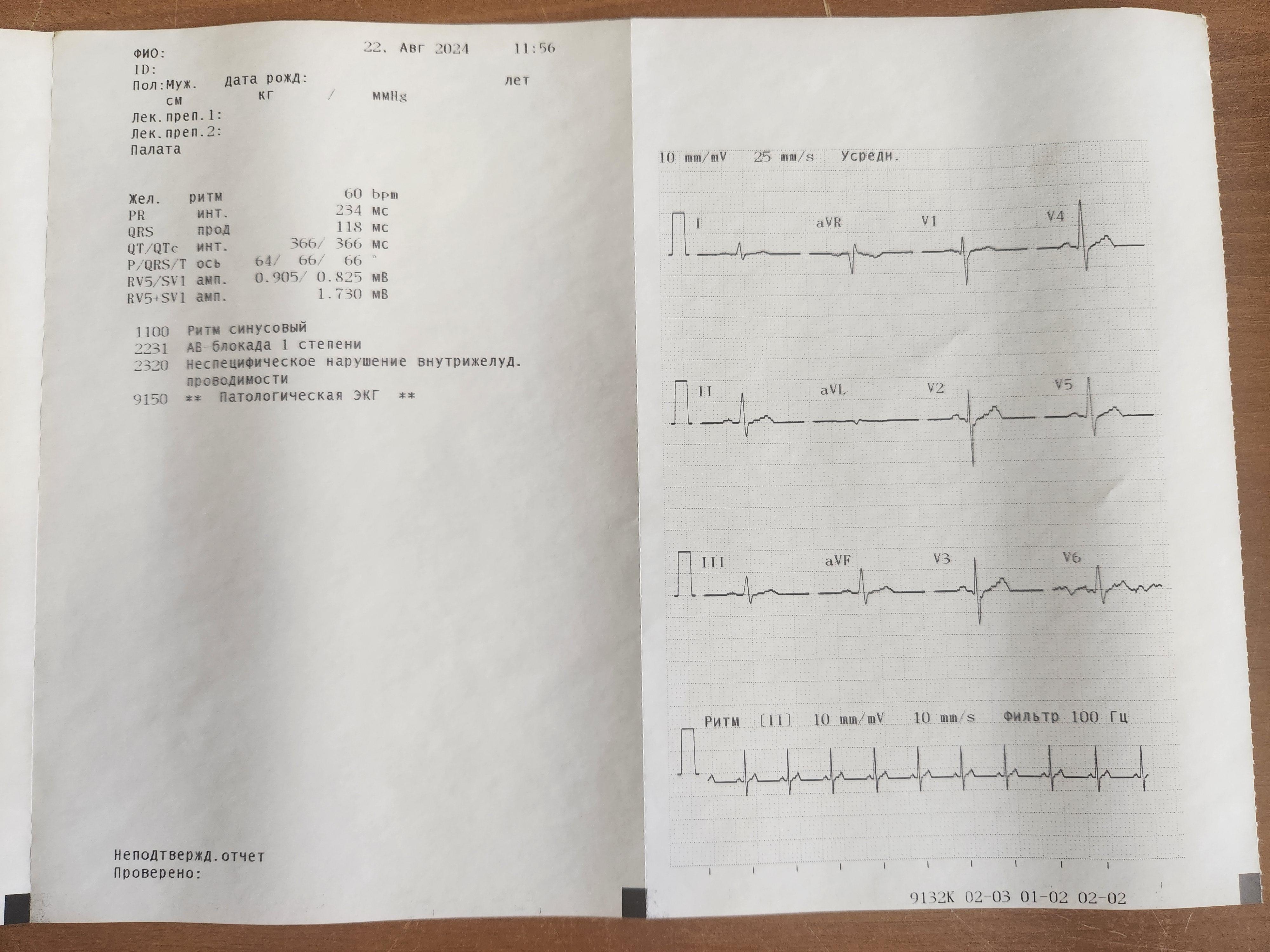 Электрокардиограф ECG-9132K Nihon Kohden 2