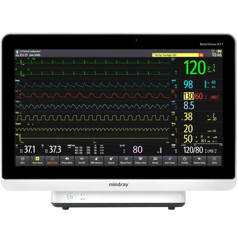 Система мониторинга физиологических показателей (монитор пациента) BeneVision N17 1