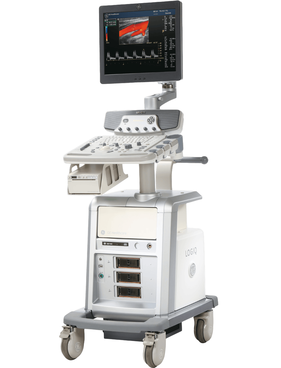 Ультразвуковой сканер Logiq P6 GE Healthcare 1