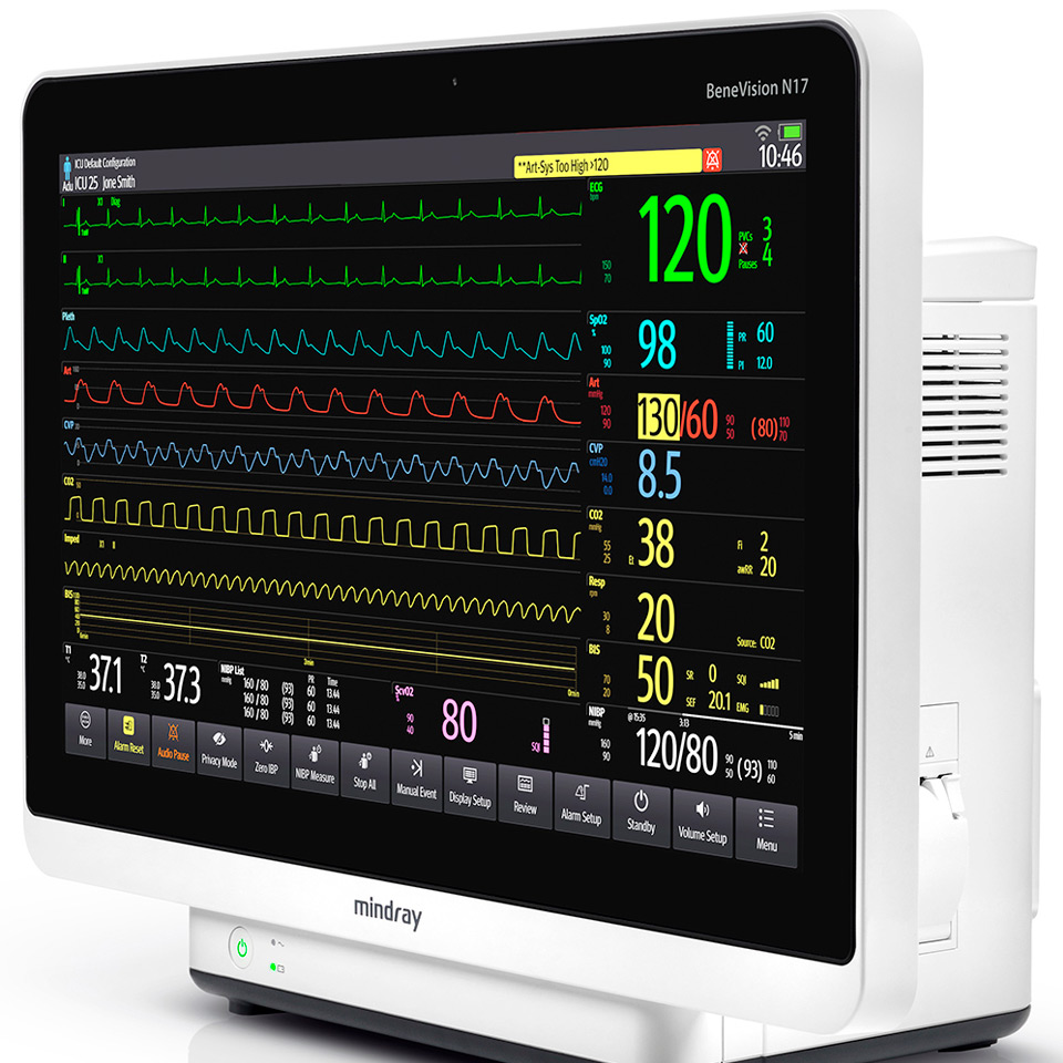 Система мониторинга физиологических показателей (монитор пациента) BeneVision N17 2