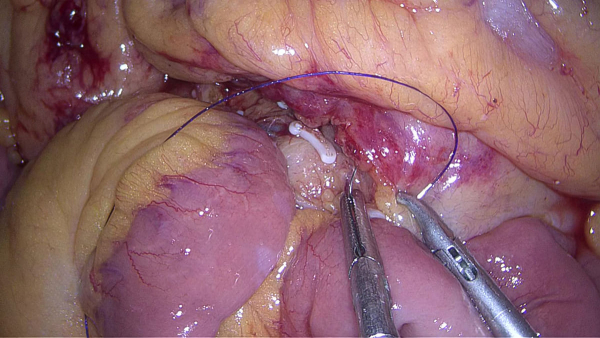 Эндоскопическая видеосистема SV-800 2