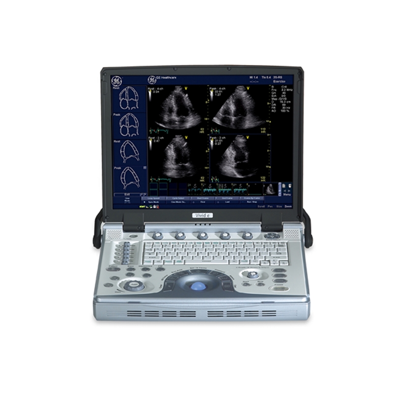 Ультразвуковой сканер Vivid e  GE Healthcare 1