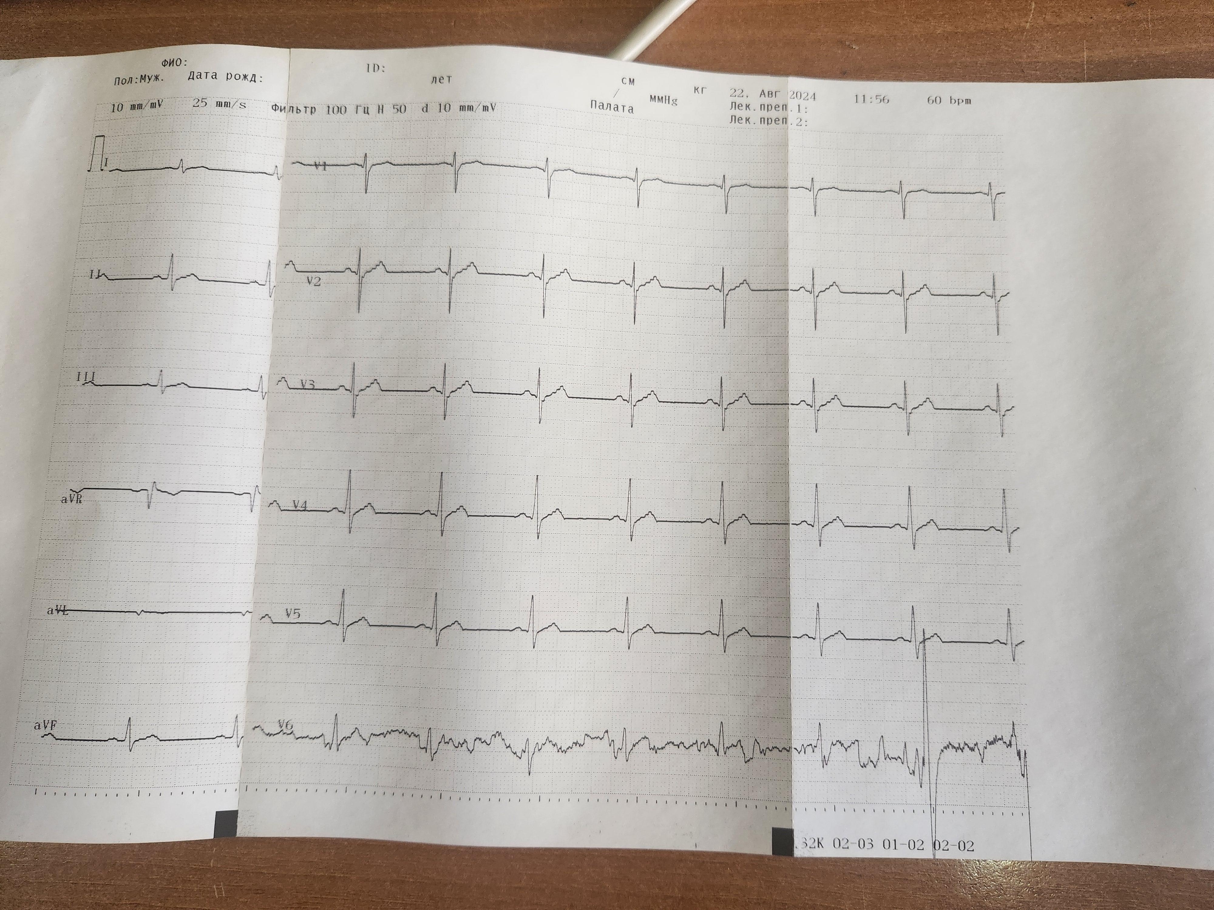 Электрокардиограф ECG-9132K Nihon Kohden 2