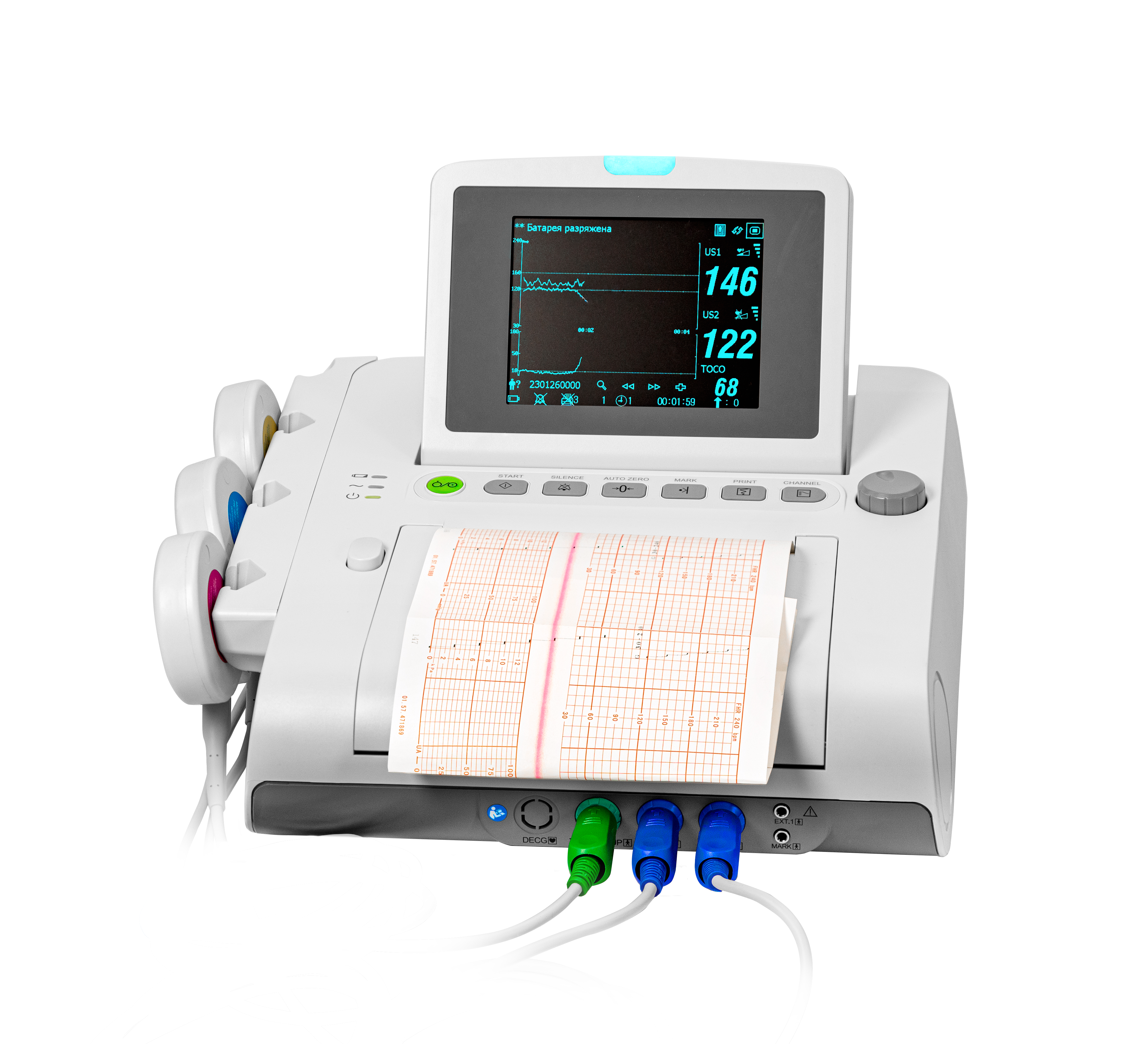 Dixion Монитор фетальный "Овертон 6200"