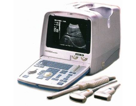 Ультразвуковой сканер HS - 2000 Honda electronics 1