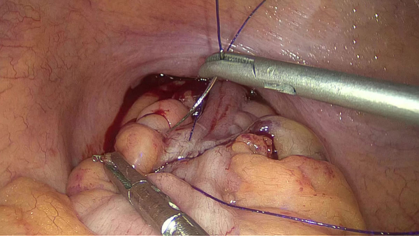 Эндоскопическая видеосистема SV-800 2