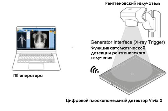 ViVIX-S.JPG